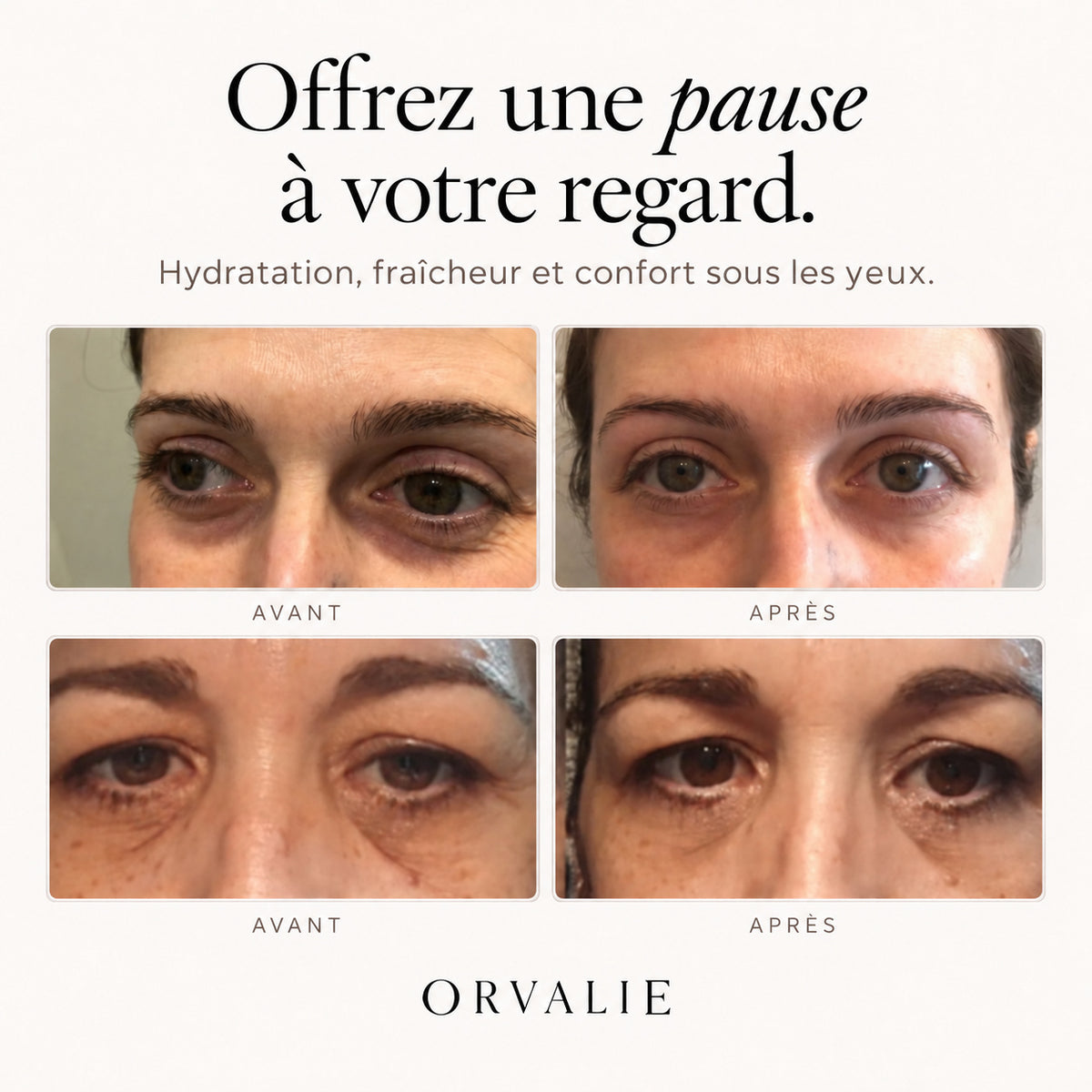 PATCHS YEUX AU COLLAGÈNE